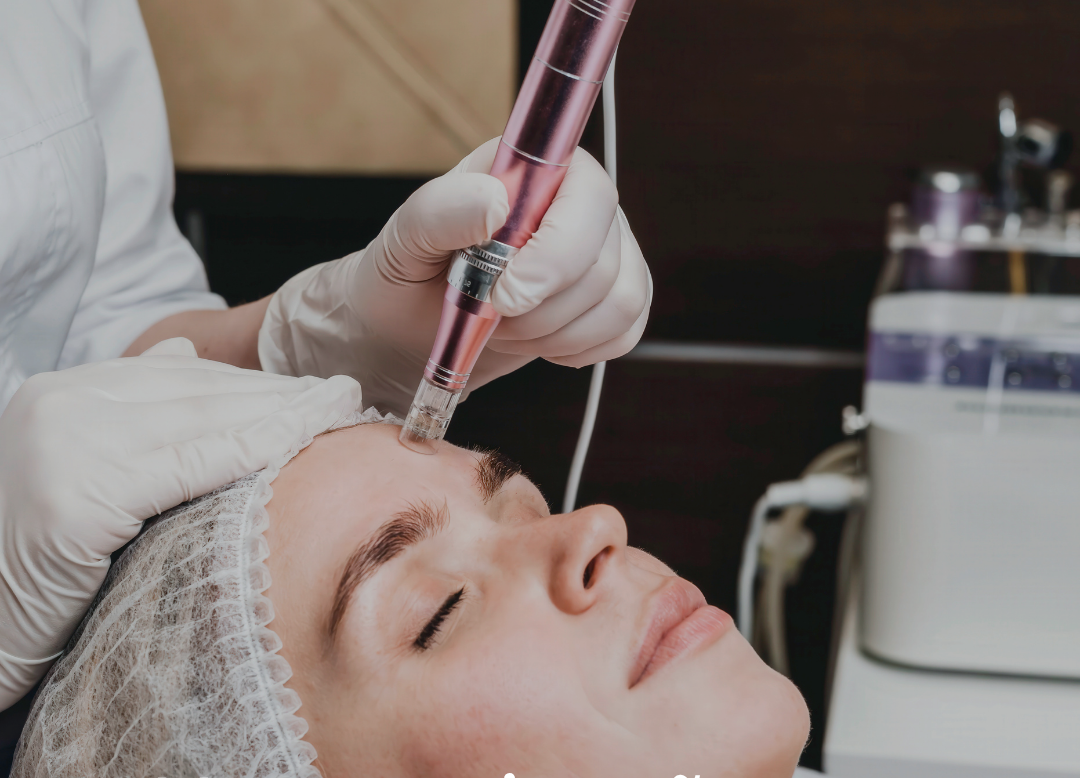 Harmonização Orofacial