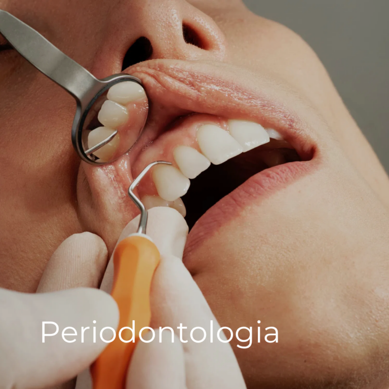 Exame periodontal em pormenor — sonda e espelho a avaliar a gengiva de um paciente