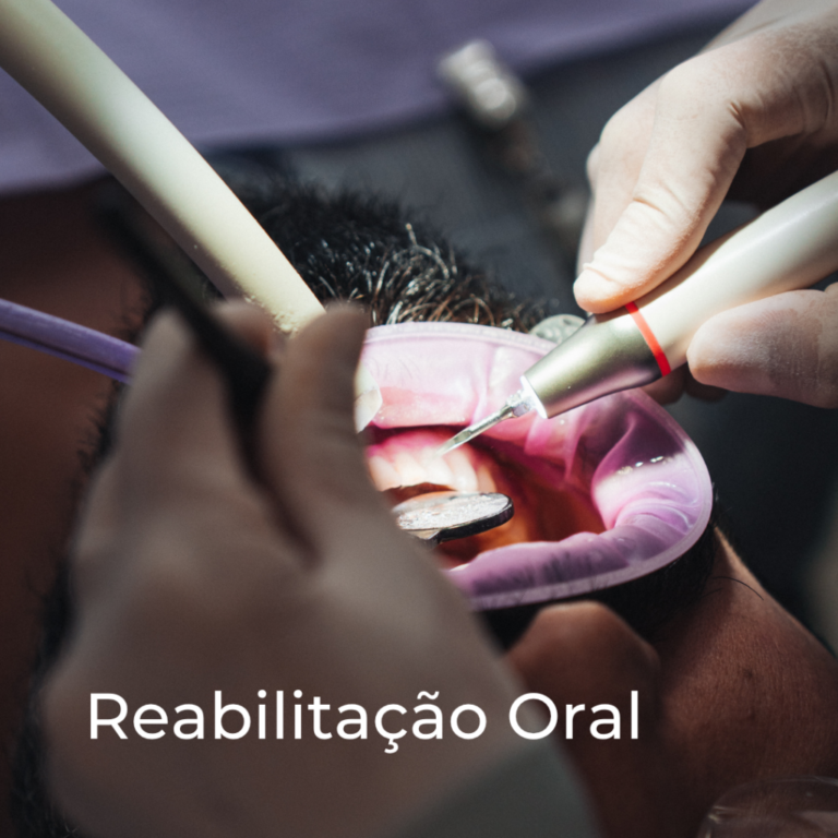 Tratamento de reabilitação oral com afastador e instrumento rotatório